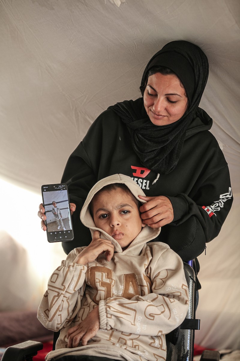 الطفل سيف رامي حجازي (13 عاما) أُصيب بشلل كامل وفشل كلوي إثر قصف إسرائيلي لخيمة عائلته، وتتولى والدته رعايته في ظروف إنسانية بالغة الصعوبة بمخيم المغازي، وسط قطاع غزة، 30 يناير/كانون الثاني 2026. صورة: معز صالحي