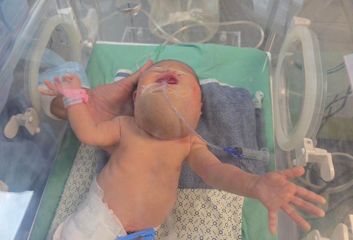 تتلقى الطفلة الفلسطينية دعاء قشطة، التي لم تتجاوز أيامًا معدودة من عمرها، العلاج في مستشفى ناصر بخان يونس، قطاع غزة، بسبب تورم حاد في حلقها يؤثر بشكل مباشر على تنفسها وتغذيتها، 18 يناير/كانون الثاني 2026. صورة: طارق محمد