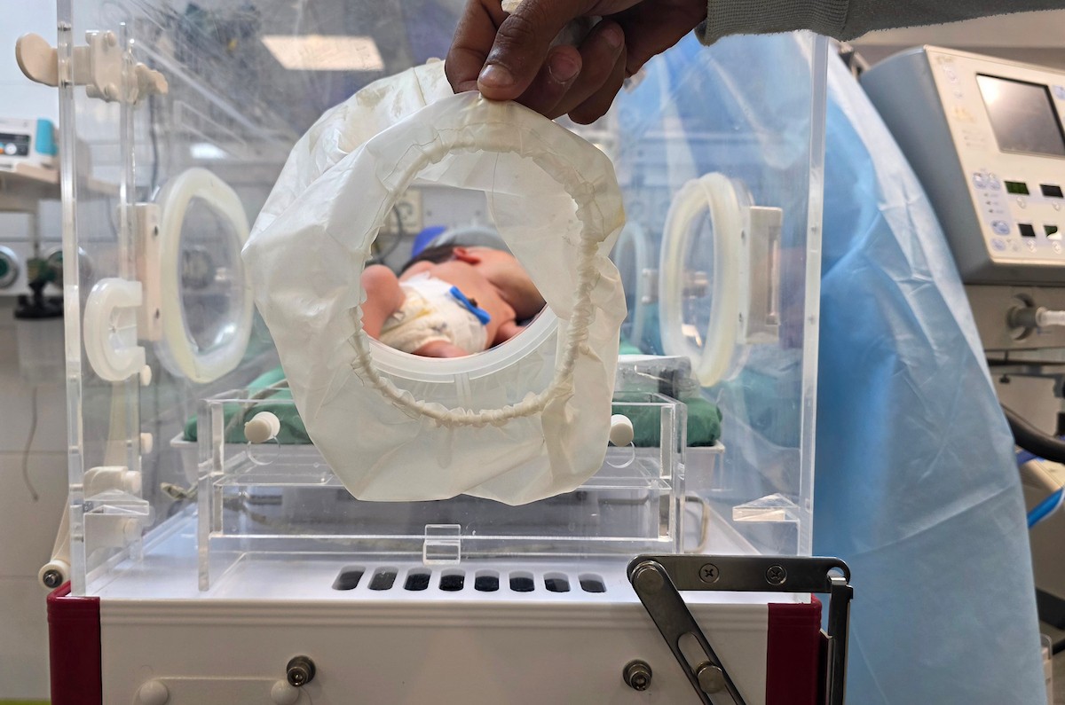 تتلقى الطفلة الفلسطينية دعاء قشطة، التي لم تتجاوز أيامًا معدودة من عمرها، العلاج في مستشفى ناصر بخان يونس، قطاع غزة، بسبب تورم حاد في حلقها يؤثر بشكل مباشر على تنفسها وتغذيتها، 18 يناير/كانون الثاني 2026. صورة: طارق محمد