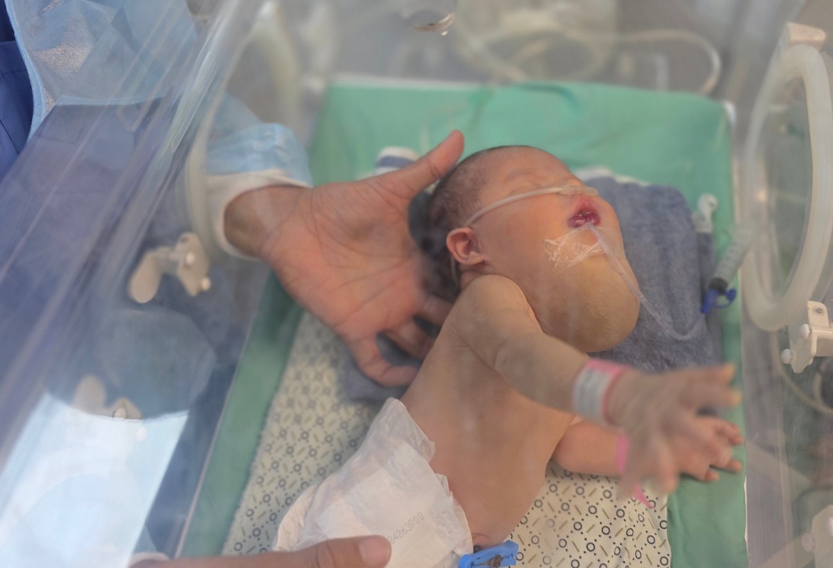 تتلقى الطفلة الفلسطينية دعاء قشطة، التي لم تتجاوز أيامًا معدودة من عمرها، العلاج في مستشفى ناصر بخان يونس، قطاع غزة، بسبب تورم حاد في حلقها يؤثر بشكل مباشر على تنفسها وتغذيتها، 18 يناير/كانون الثاني 2026. صورة: طارق محمد