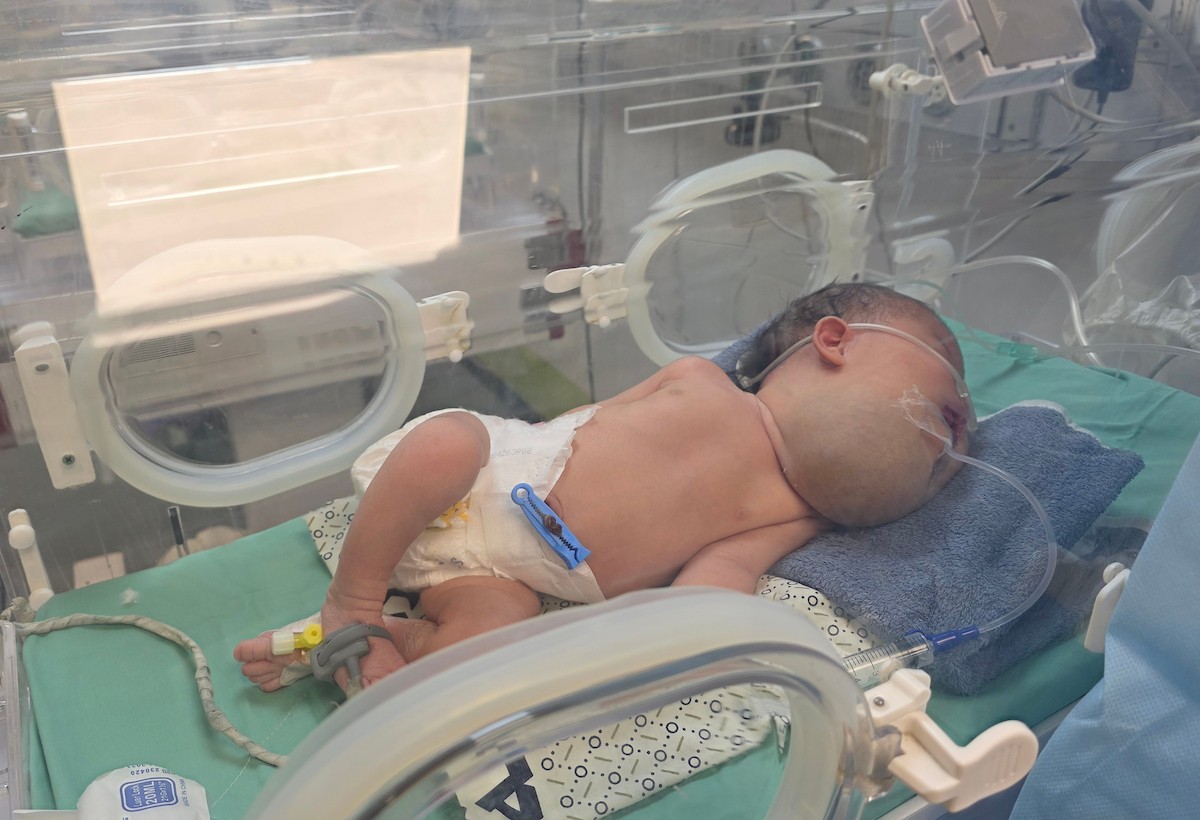 تتلقى الطفلة الفلسطينية دعاء قشطة، التي لم تتجاوز أيامًا معدودة من عمرها، العلاج في مستشفى ناصر بخان يونس، قطاع غزة، بسبب تورم حاد في حلقها يؤثر بشكل مباشر على تنفسها وتغذيتها، 18 يناير/كانون الثاني 2026. صورة: طارق محمد