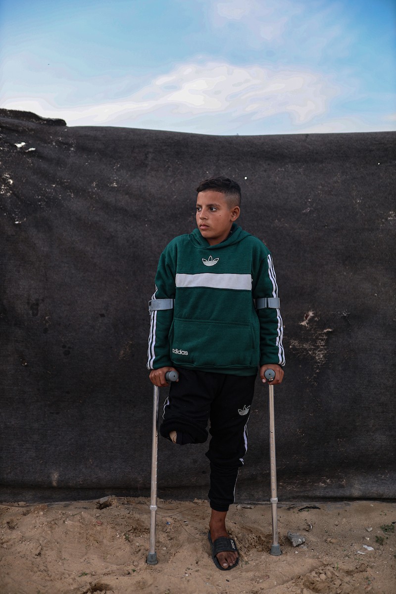 الطفل عمر حلاوة (13عاما) يزور مكان دفن ساقه المبتور يوميا، بعد إصابته في غارة إسرائيلية خلال الحرب على غزة، 31 ديسمبر/كانون الأول 2025. تصوير: عمر أشتوي