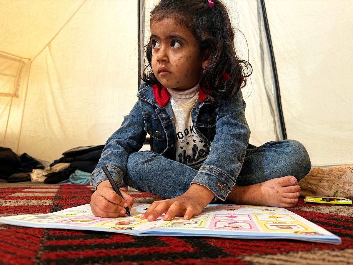 الطفلة الفلسطينية مريم دياب، 5 سنوات، تعيش مع عائلتها داخل خيمة للنازحين أسفل منزل مدمر جراء القصف في حي النصر بمدينة غزة. تعاني مريم من فشل نخاع العظم ونقص حاد في الصفائح الدموية، وهي تنتظر نقلها إلى الخارج لإجراء عملية زرع نخاع عظم قد تنقذ حياتها، 15 فبراير/شباط 2026. تصوير: محمد الأسود.