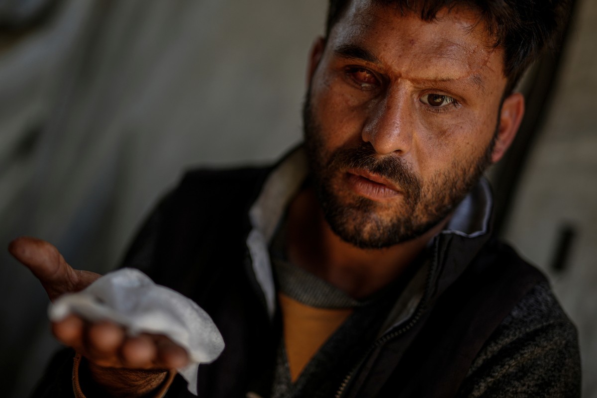 الفلسطيني لؤي أسامة صبح، 27 عامًا، أصيب بإعاقات دائمة وفقد بصره تمامًا جراء هجمات إسرائيلية، يكافح من أجل مواصلة حياته اليومية داخل خيمته في مدينة غزة في 11 فبراير/شباط 2026. صورة: عمر أشتوي