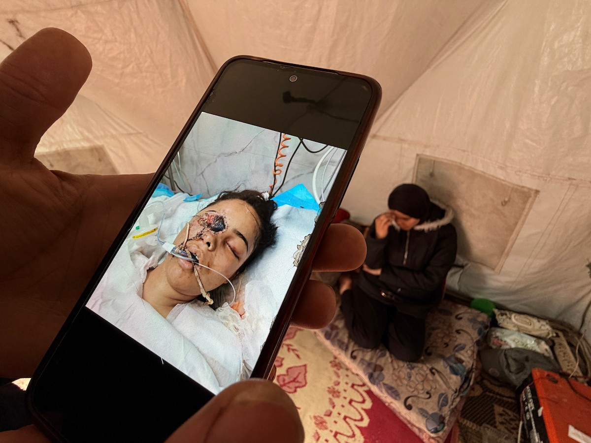 ندى رحومة، طفلة (16 عامًا) نازحة بمنطقة الزوايدة وسط القطاع، ُأصيبت في غارة إسرائيلية قرب خيمة عائلتها في مدينة غزة وفقدت إحدى عينيها، وهي مُعرّضة لخطر فقدان البصر في العين الأخرى إذا لم تتلقَّ علاجًا طبيًا عاجلًا، 10 فبراير/شباط 2026. تصوير: محمد الأسود