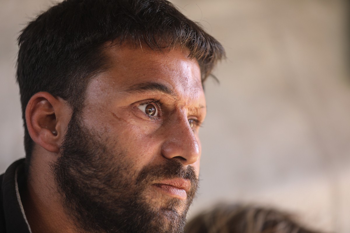 الفلسطيني لؤي أسامة صبح، 27 عامًا، أصيب بإعاقات دائمة وفقد بصره تمامًا جراء هجمات إسرائيلية، يكافح من أجل مواصلة حياته اليومية داخل خيمته في مدينة غزة في 11 فبراير/شباط 2026. صورة: عمر أشتوي