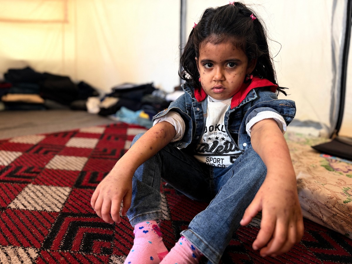 الطفلة الفلسطينية مريم دياب، 5 سنوات، تعيش مع عائلتها داخل خيمة للنازحين أسفل منزل مدمر جراء القصف في حي النصر بمدينة غزة. تعاني مريم من فشل نخاع العظم ونقص حاد في الصفائح الدموية، وهي تنتظر نقلها إلى الخارج لإجراء عملية زرع نخاع عظم قد تنقذ حياتها، 15 فبراير/شباط 2026. تصوير: محمد الأسود.