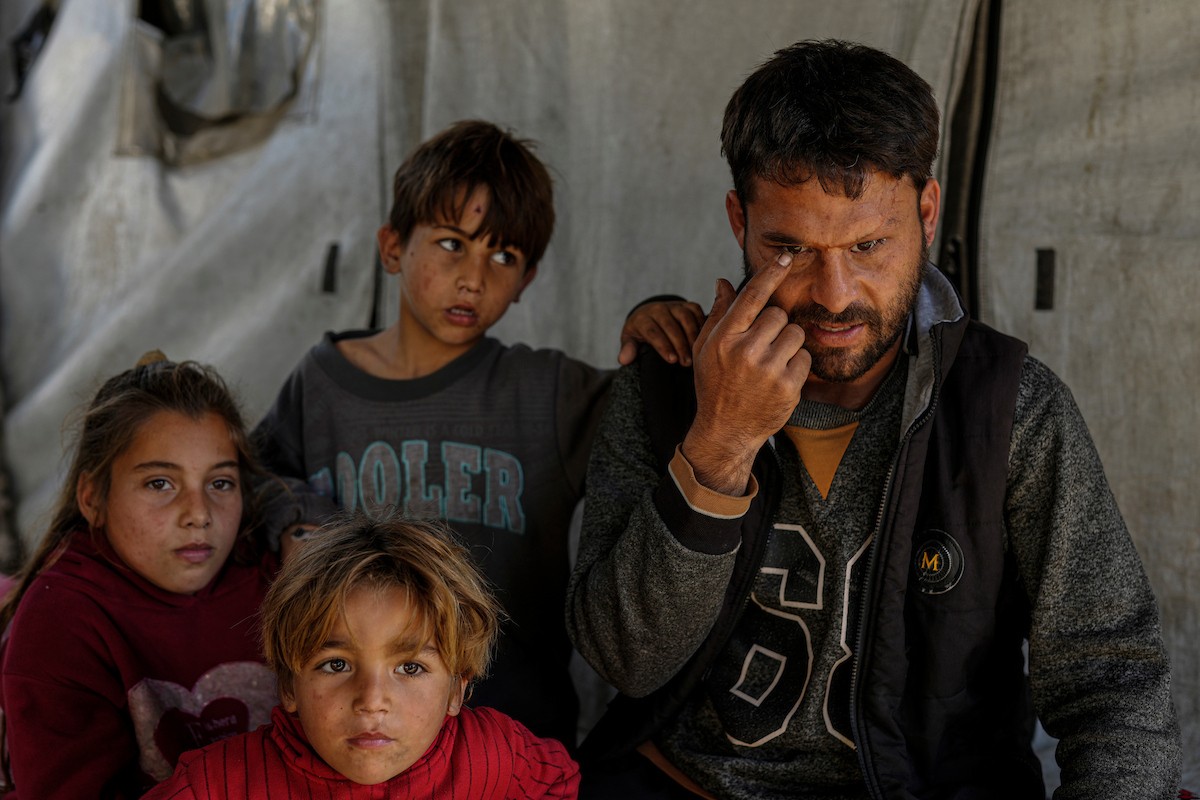 الفلسطيني لؤي أسامة صبح، 27 عامًا، أصيب بإعاقات دائمة وفقد بصره تمامًا جراء هجمات إسرائيلية، يكافح من أجل مواصلة حياته اليومية داخل خيمته في مدينة غزة في 11 فبراير/شباط 2026. صورة: عمر أشتوي