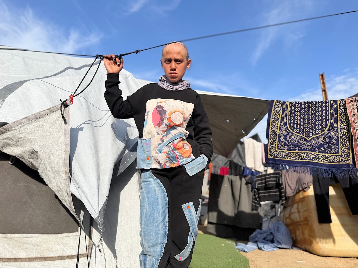 الطفلة لما أبو مطيير (15 عاما)، تعاني من تساقط كامل للشعر بسبب داء الثعلبة الذي اصابها نتيجة الظروف الإنسانية الصعبة ونقص الرعاية الصحية المتوفرة في مخيم الشاطئ للاجئين غرب مدينة غزة ، 9 فبراير/شباط 2026. تصوير: محمد الأسود