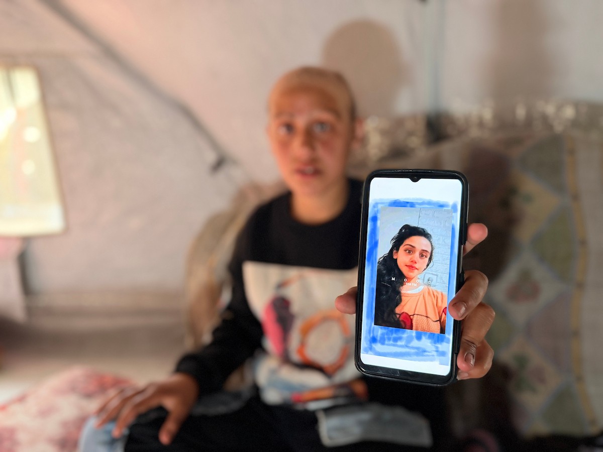 الطفلة لما أبو مطيير (15 عاما)، تعاني من تساقط كامل للشعر بسبب داء الثعلبة الذي اصابها نتيجة الظروف الإنسانية الصعبة ونقص الرعاية الصحية المتوفرة في مخيم الشاطئ للاجئين غرب مدينة غزة ، 9 فبراير/شباط 2026. تصوير: محمد الأسود