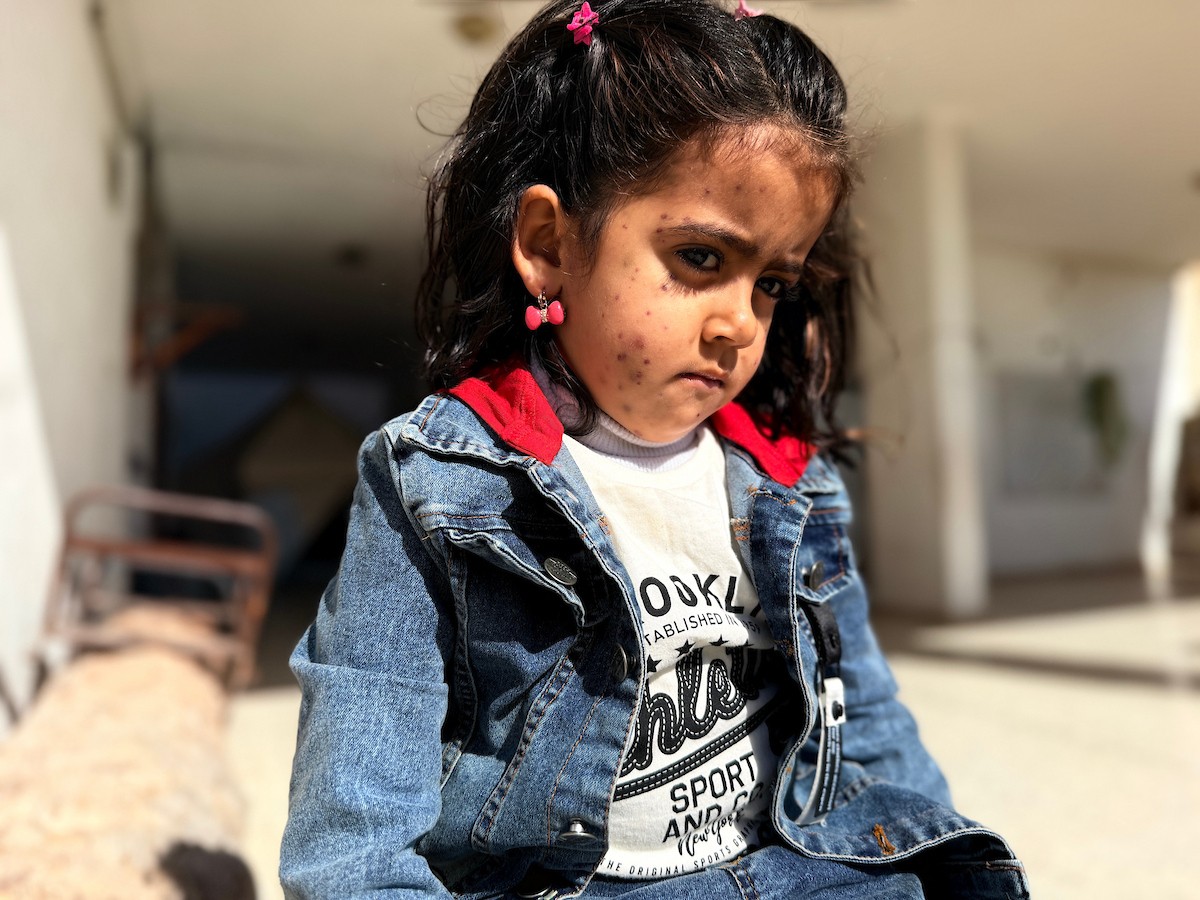 الطفلة الفلسطينية مريم دياب، 5 سنوات، تعيش مع عائلتها داخل خيمة للنازحين أسفل منزل مدمر جراء القصف في حي النصر بمدينة غزة. تعاني مريم من فشل نخاع العظم ونقص حاد في الصفائح الدموية، وهي تنتظر نقلها إلى الخارج لإجراء عملية زرع نخاع عظم قد تنقذ حياتها، 15 فبراير/شباط 2026. تصوير: محمد الأسود.