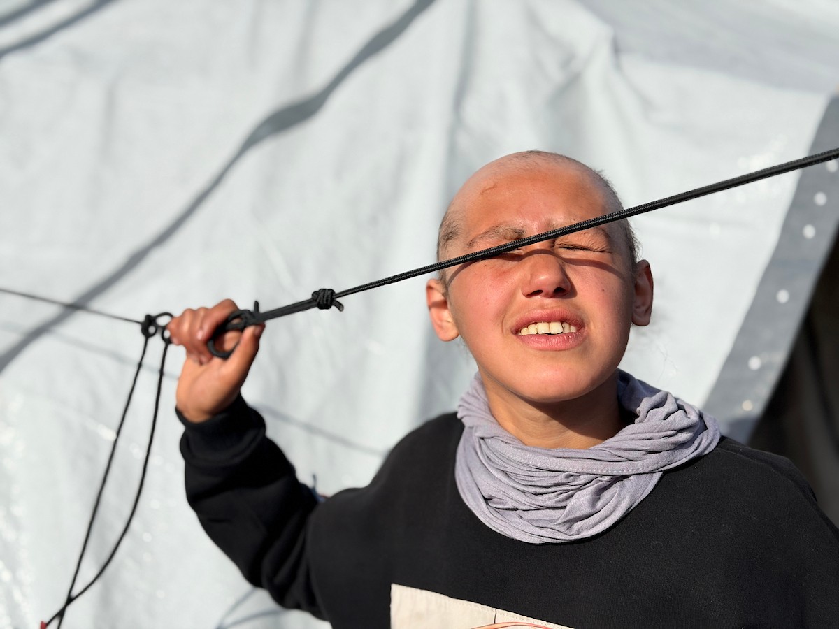 الطفلة لما أبو مطيير (15 عاما)، تعاني من تساقط كامل للشعر بسبب داء الثعلبة الذي اصابها نتيجة الظروف الإنسانية الصعبة ونقص الرعاية الصحية المتوفرة في مخيم الشاطئ للاجئين غرب مدينة غزة ، 9 فبراير/شباط 2026. تصوير: محمد الأسود