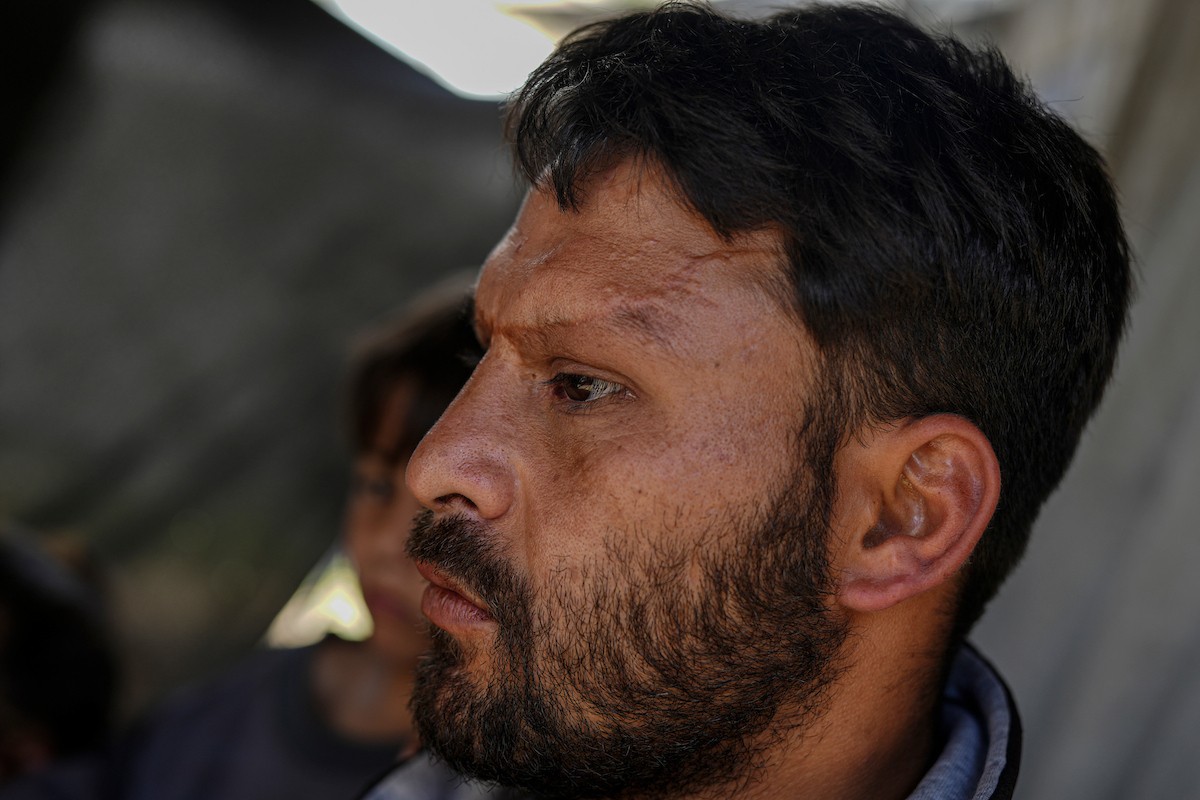 الفلسطيني لؤي أسامة صبح، 27 عامًا، أصيب بإعاقات دائمة وفقد بصره تمامًا جراء هجمات إسرائيلية، يكافح من أجل مواصلة حياته اليومية داخل خيمته في مدينة غزة في 11 فبراير/شباط 2026. صورة: عمر أشتوي