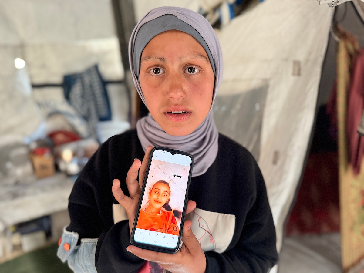 الطفلة لما أبو مطيير (15 عاما)، تعاني من تساقط كامل للشعر بسبب داء الثعلبة الذي اصابها نتيجة الظروف الإنسانية الصعبة ونقص الرعاية الصحية المتوفرة في مخيم الشاطئ للاجئين غرب مدينة غزة ، 9 فبراير/شباط 2026. تصوير: محمد الأسود