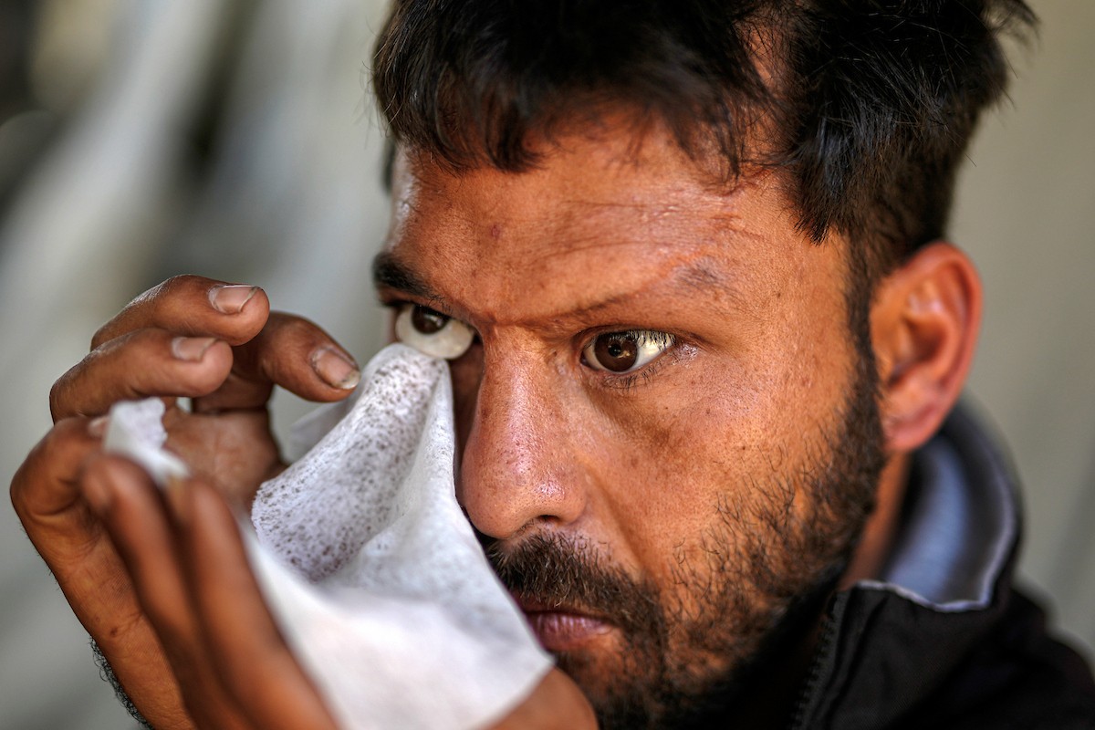 الفلسطيني لؤي أسامة صبح، 27 عامًا، أصيب بإعاقات دائمة وفقد بصره تمامًا جراء هجمات إسرائيلية، يكافح من أجل مواصلة حياته اليومية داخل خيمته في مدينة غزة في 11 فبراير/شباط 2026. صورة: عمر أشتوي