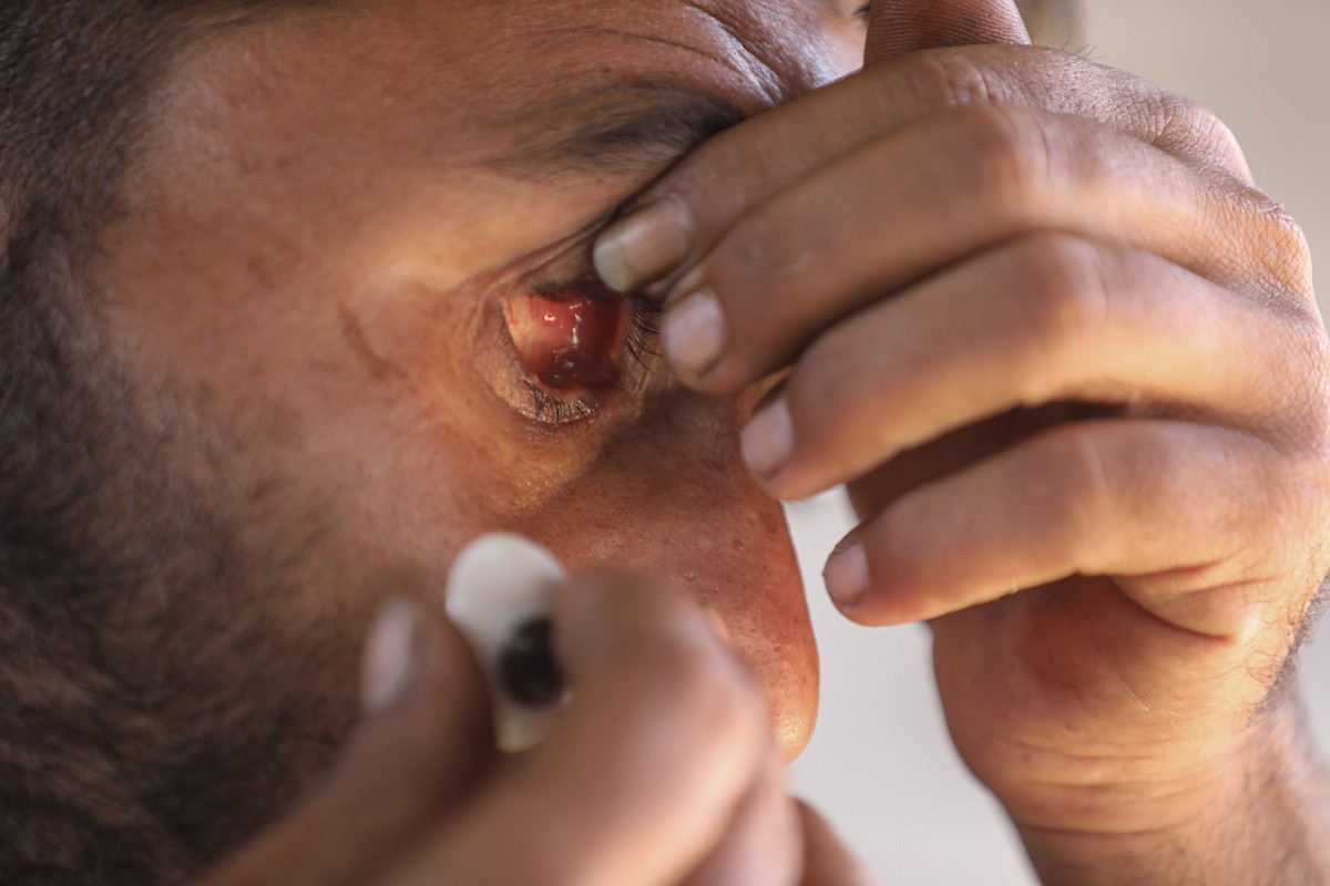 الفلسطيني لؤي أسامة صبح، 27 عامًا، أصيب بإعاقات دائمة وفقد بصره تمامًا جراء هجمات إسرائيلية، يكافح من أجل مواصلة حياته اليومية داخل خيمته في مدينة غزة في 11 فبراير/شباط 2026. صورة: عمر أشتوي