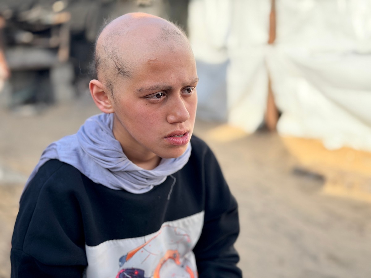 الطفلة لما أبو مطيير (15 عاما)، تعاني من تساقط كامل للشعر بسبب داء الثعلبة الذي اصابها نتيجة الظروف الإنسانية الصعبة ونقص الرعاية الصحية المتوفرة في مخيم الشاطئ للاجئين غرب مدينة غزة ، 9 فبراير/شباط 2026. تصوير: محمد الأسود
