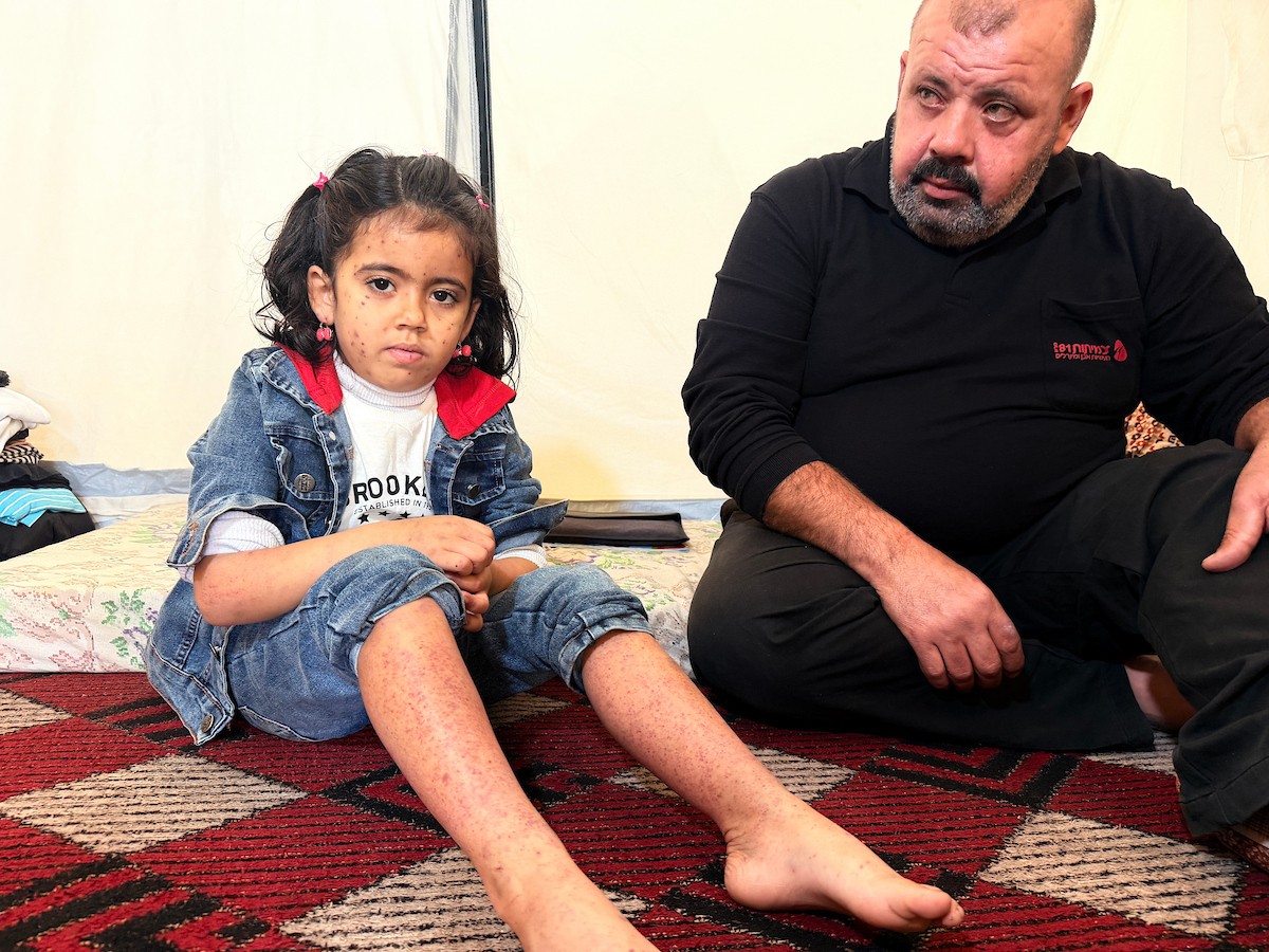 الطفلة الفلسطينية مريم دياب، 5 سنوات، تعيش مع عائلتها داخل خيمة للنازحين أسفل منزل مدمر جراء القصف في حي النصر بمدينة غزة. تعاني مريم من فشل نخاع العظم ونقص حاد في الصفائح الدموية، وهي تنتظر نقلها إلى الخارج لإجراء عملية زرع نخاع عظم قد تنقذ حياتها، 15 فبراير/شباط 2026. تصوير: محمد الأسود.