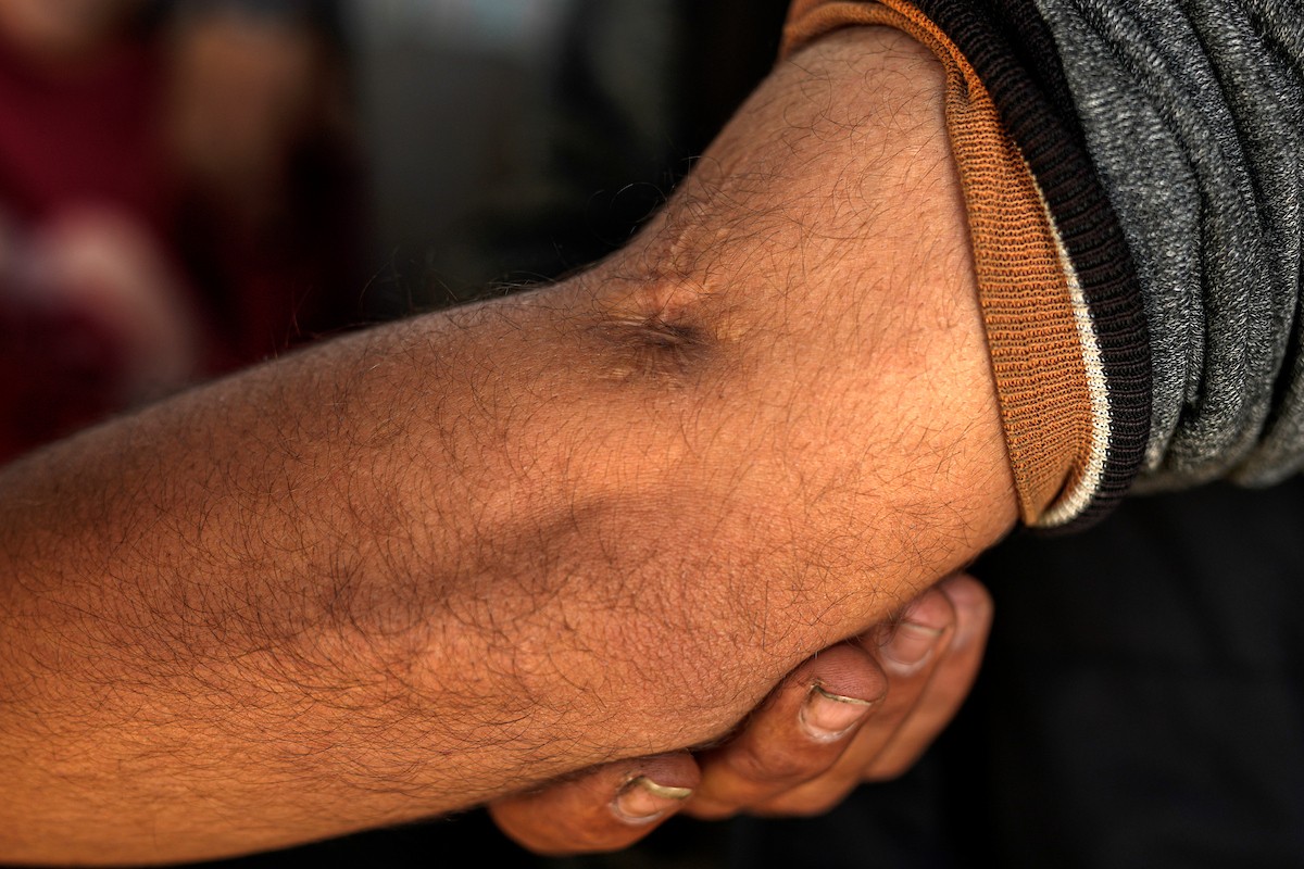 الفلسطيني لؤي أسامة صبح، 27 عامًا، أصيب بإعاقات دائمة وفقد بصره تمامًا جراء هجمات إسرائيلية، يكافح من أجل مواصلة حياته اليومية داخل خيمته في مدينة غزة في 11 فبراير/شباط 2026. صورة: عمر أشتوي