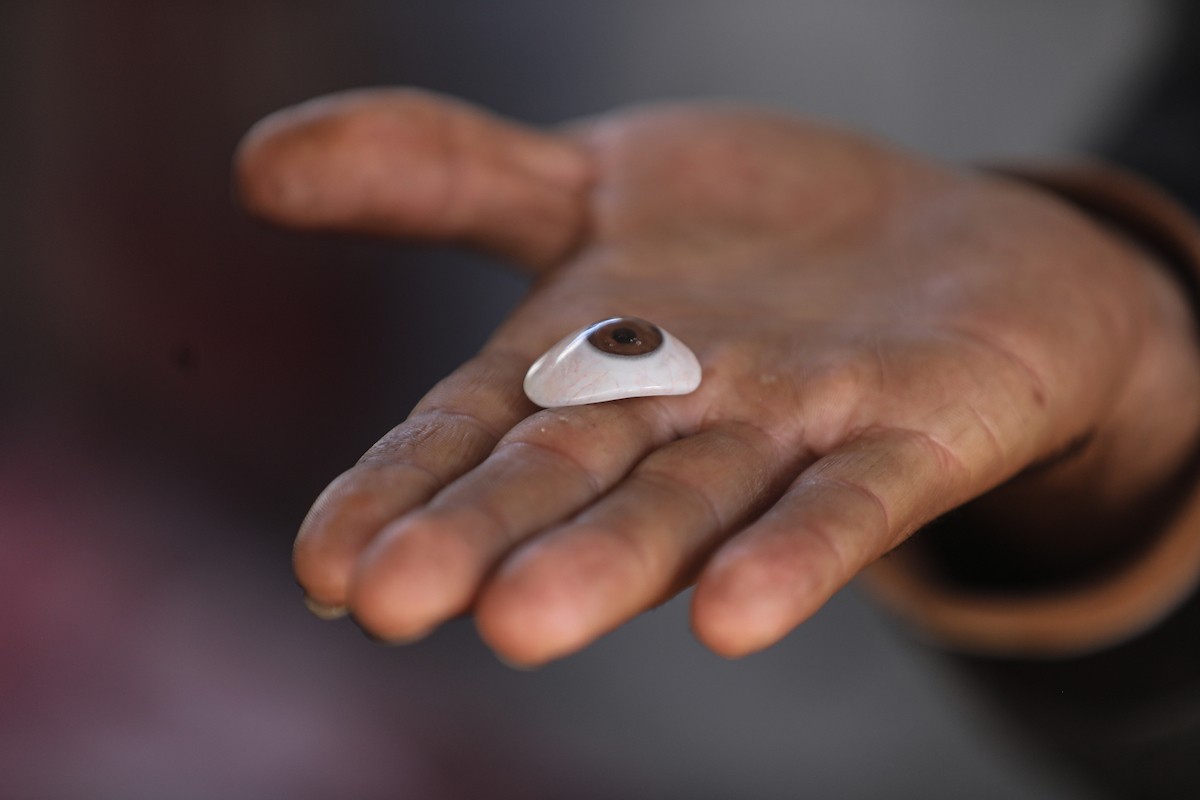 الفلسطيني لؤي أسامة صبح، 27 عامًا، أصيب بإعاقات دائمة وفقد بصره تمامًا جراء هجمات إسرائيلية، يكافح من أجل مواصلة حياته اليومية داخل خيمته في مدينة غزة في 11 فبراير/شباط 2026. صورة: عمر أشتوي