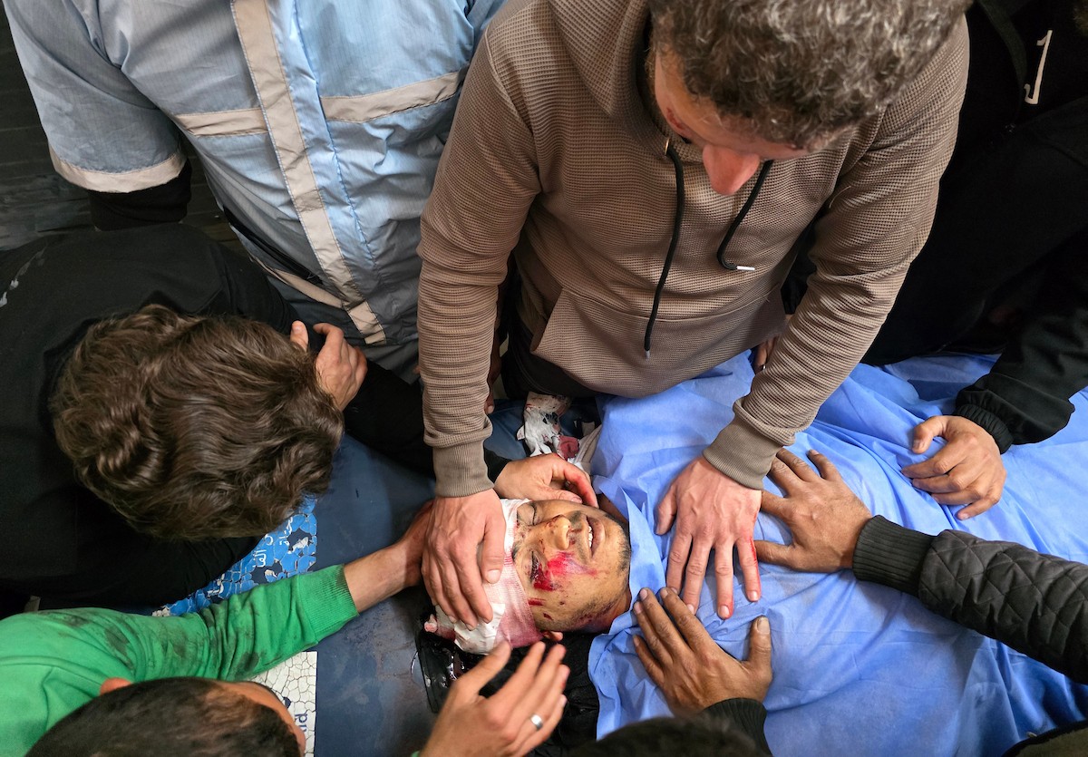 وصل جثمان فلسطيني وعدد من الجرحى إلى مجمع ناصر الطبي بعد أن استهدفت طائرة استطلاع إسرائيلية خيمة تأوي نازحين في خان يونس، جنوب قطاع غزة، في 27 فبراير/شباط 2026