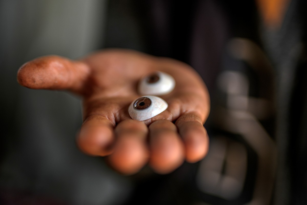 الفلسطيني لؤي أسامة صبح، 27 عامًا، أصيب بإعاقات دائمة وفقد بصره تمامًا جراء هجمات إسرائيلية، يكافح من أجل مواصلة حياته اليومية داخل خيمته في مدينة غزة في 11 فبراير/شباط 2026. صورة: عمر أشتوي