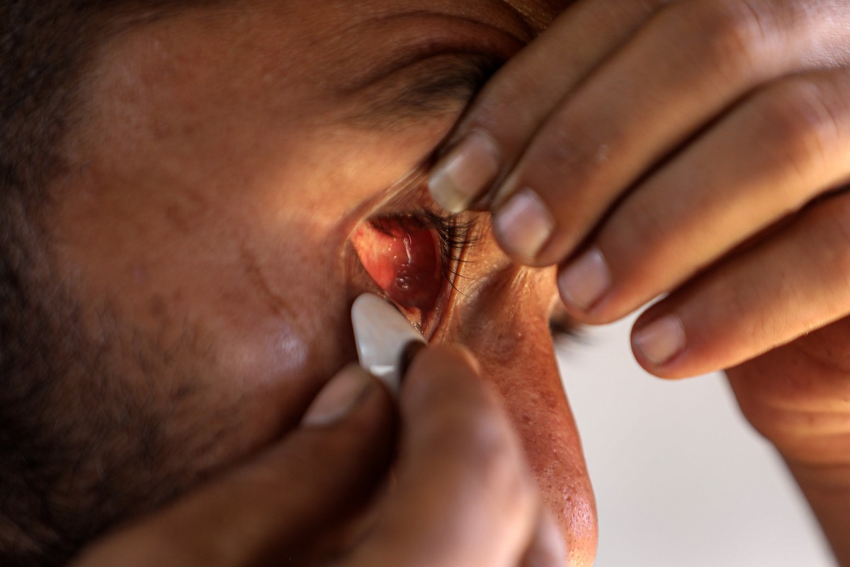 الفلسطيني لؤي أسامة صبح، 27 عامًا، أصيب بإعاقات دائمة وفقد بصره تمامًا جراء هجمات إسرائيلية، يكافح من أجل مواصلة حياته اليومية داخل خيمته في مدينة غزة في 11 فبراير/شباط 2026. صورة: عمر أشتوي