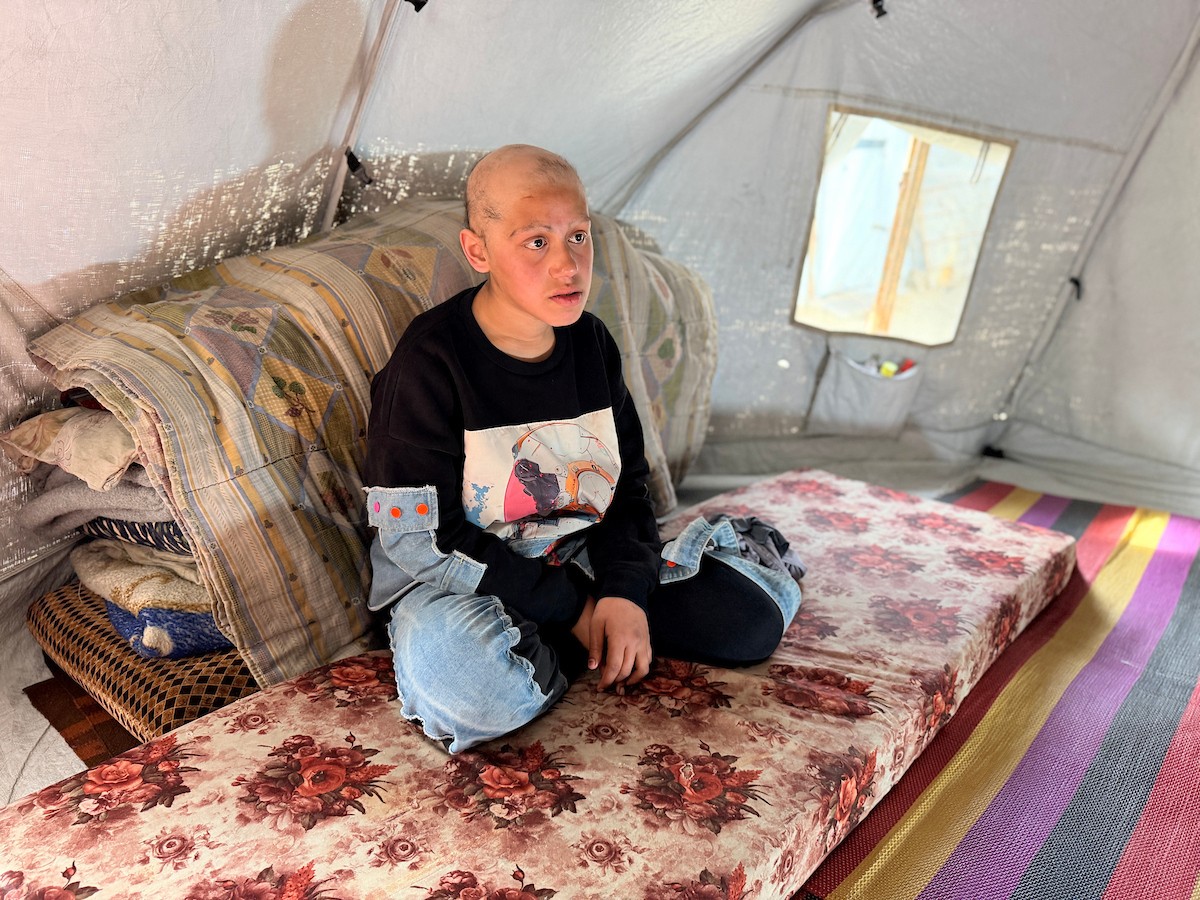 الطفلة لما أبو مطيير (15 عاما)، تعاني من تساقط كامل للشعر بسبب داء الثعلبة الذي اصابها نتيجة الظروف الإنسانية الصعبة ونقص الرعاية الصحية المتوفرة في مخيم الشاطئ للاجئين غرب مدينة غزة ، 9 فبراير/شباط 2026. تصوير: محمد الأسود