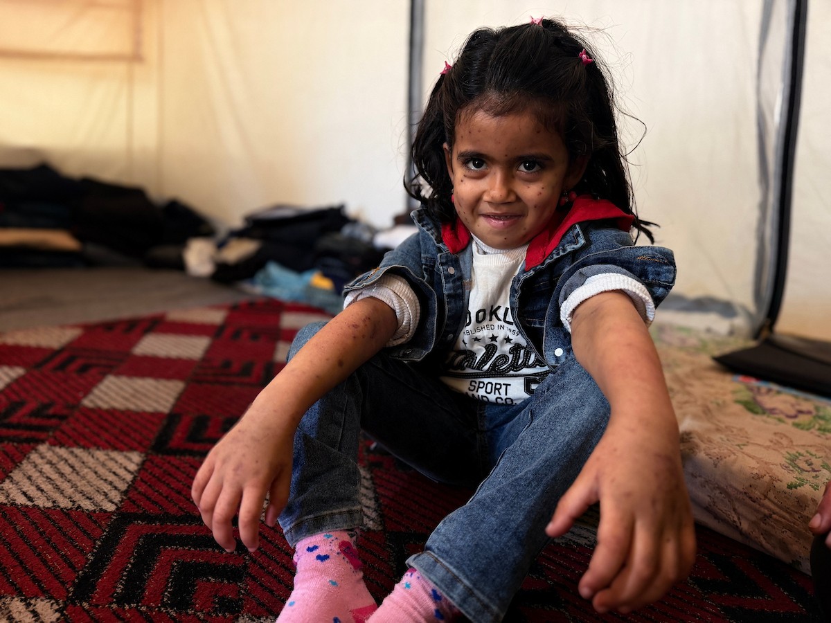 الطفلة الفلسطينية مريم دياب، 5 سنوات، تعيش مع عائلتها داخل خيمة للنازحين أسفل منزل مدمر جراء القصف في حي النصر بمدينة غزة. تعاني مريم من فشل نخاع العظم ونقص حاد في الصفائح الدموية، وهي تنتظر نقلها إلى الخارج لإجراء عملية زرع نخاع عظم قد تنقذ حياتها، 15 فبراير/شباط 2026. تصوير: محمد الأسود.