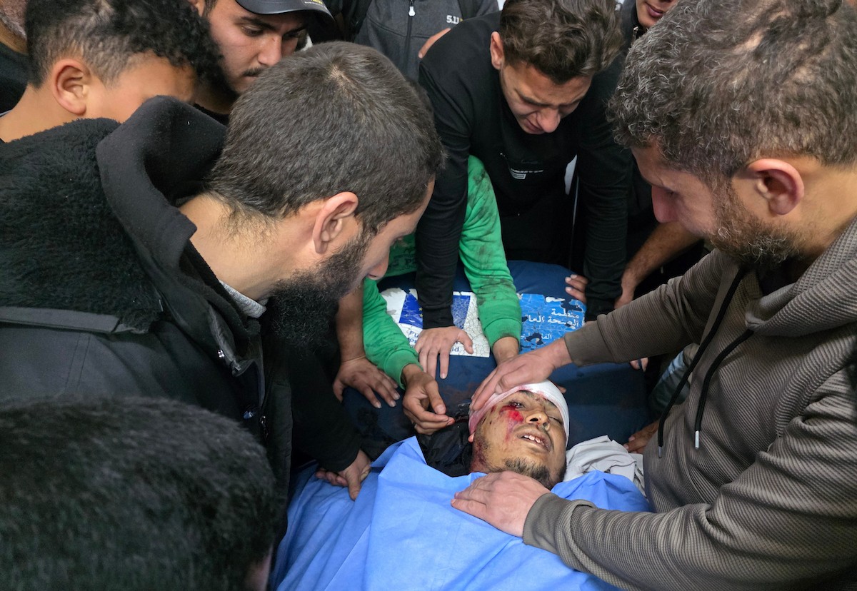 وصل جثمان فلسطيني وعدد من الجرحى إلى مجمع ناصر الطبي بعد أن استهدفت طائرة استطلاع إسرائيلية خيمة تأوي نازحين في خان يونس، جنوب قطاع غزة، في 27 فبراير/شباط 2026