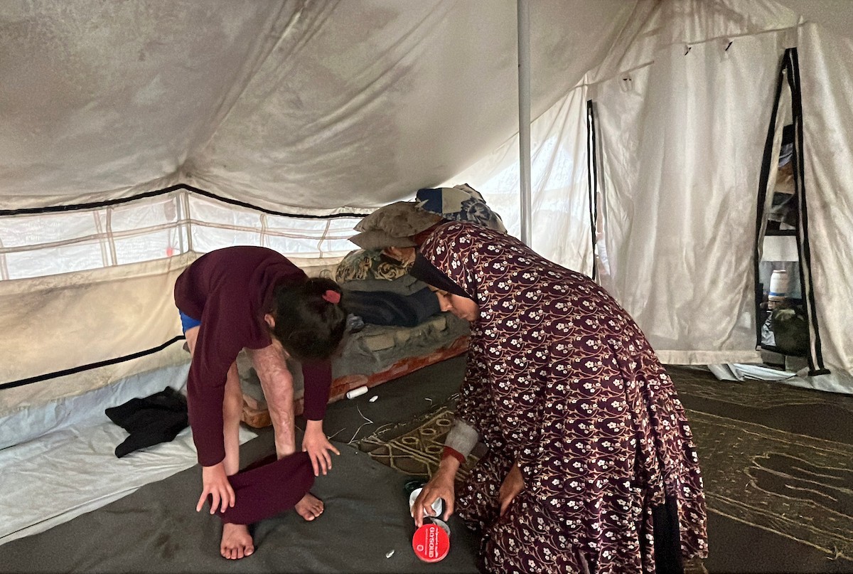 الطفلة رنين جندية مصابة بحروق في جسدها جراء غارة جوية إسرائيلية استهدفت خيمة قرب مخيمها في خان يونس، وتحتاج إلى استكمال العلاج خارج قطاع غزة.مدينة غزة، 1 فبراير/شباط 2026. صورة: مطر الزاق.