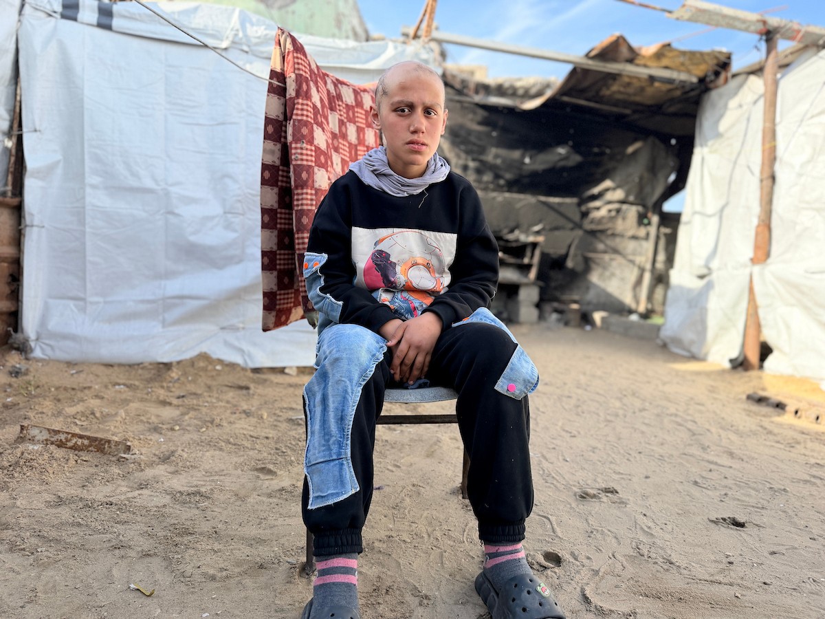 الطفلة لما أبو مطيير (15 عاما)، تعاني من تساقط كامل للشعر بسبب داء الثعلبة الذي اصابها نتيجة الظروف الإنسانية الصعبة ونقص الرعاية الصحية المتوفرة في مخيم الشاطئ للاجئين غرب مدينة غزة ، 9 فبراير/شباط 2026. تصوير: محمد الأسود