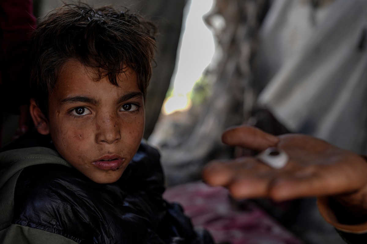 الفلسطيني لؤي أسامة صبح، 27 عامًا، أصيب بإعاقات دائمة وفقد بصره تمامًا جراء هجمات إسرائيلية، يكافح من أجل مواصلة حياته اليومية داخل خيمته في مدينة غزة في 11 فبراير/شباط 2026. صورة: عمر أشتوي