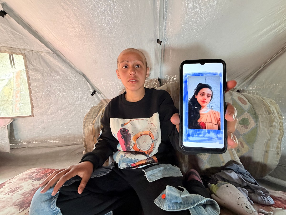 الطفلة لما أبو مطيير (15 عاما)، تعاني من تساقط كامل للشعر بسبب داء الثعلبة الذي اصابها نتيجة الظروف الإنسانية الصعبة ونقص الرعاية الصحية المتوفرة في مخيم الشاطئ للاجئين غرب مدينة غزة ، 9 فبراير/شباط 2026. تصوير: محمد الأسود