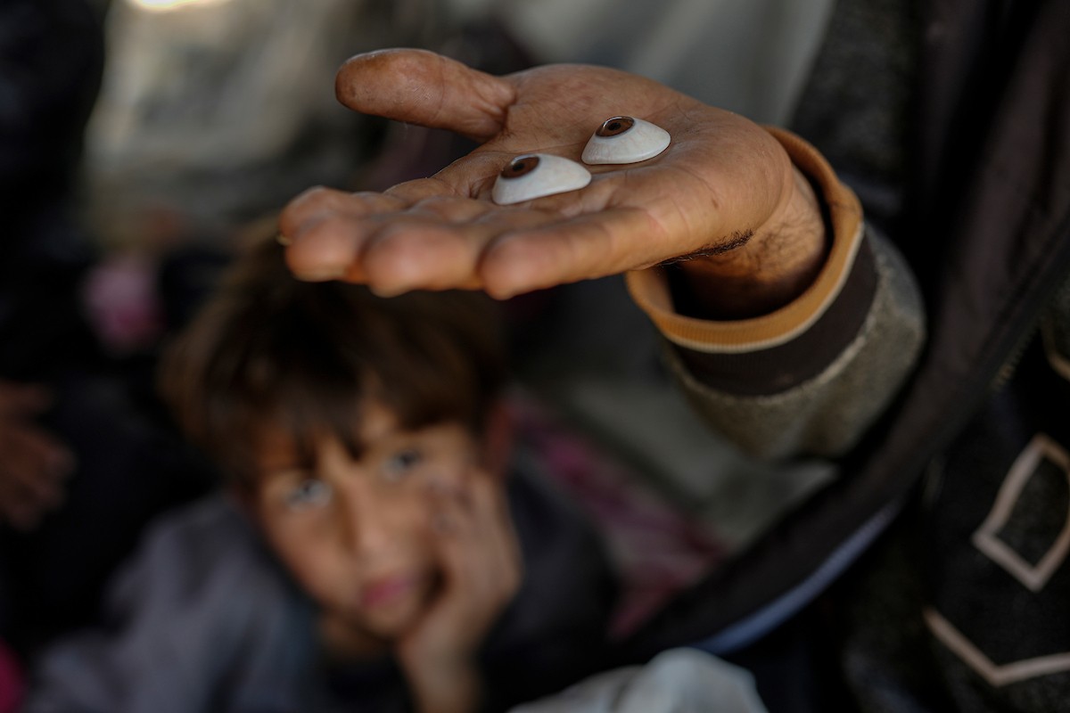 الفلسطيني لؤي أسامة صبح، 27 عامًا، أصيب بإعاقات دائمة وفقد بصره تمامًا جراء هجمات إسرائيلية، يكافح من أجل مواصلة حياته اليومية داخل خيمته في مدينة غزة في 11 فبراير/شباط 2026. صورة: عمر أشتوي