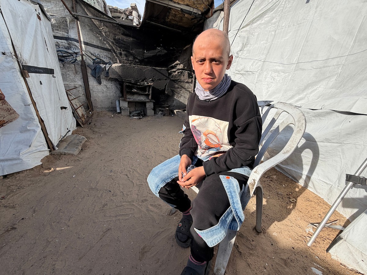 الطفلة لما أبو مطيير (15 عاما)، تعاني من تساقط كامل للشعر بسبب داء الثعلبة الذي اصابها نتيجة الظروف الإنسانية الصعبة ونقص الرعاية الصحية المتوفرة في مخيم الشاطئ للاجئين غرب مدينة غزة ، 9 فبراير/شباط 2026. تصوير: محمد الأسود