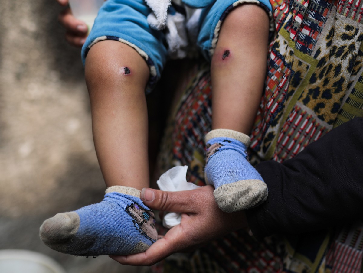 تعرض الرضيع جواد أسامة أبو نصار لإصابات جسدية ونفسية بعد اعتقاله هو ووالده من قبل القوات الإسرائيلية قرب مخيم المغازي للاجئين في قطاع غزة، 24 مارس/آذار 2026. صورة: رمزي أبو عامر