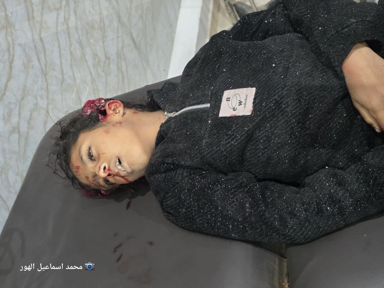 طفلة استشهدت جراء قصف الاحتلال خيام النازحين في منطقة السوارحة وسط قطاع غزة..jpg