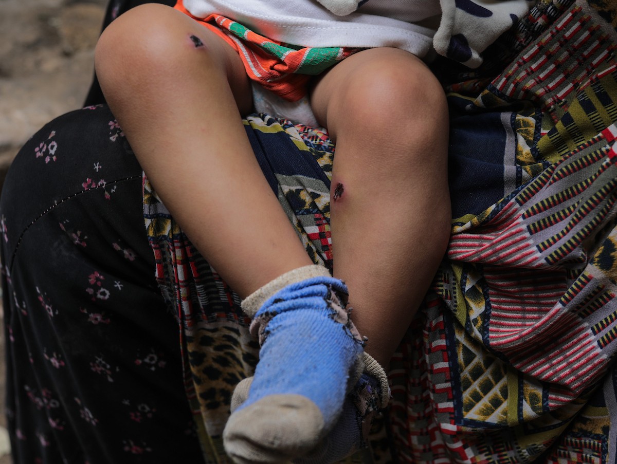 تعرض الرضيع جواد أسامة أبو نصار لإصابات جسدية ونفسية بعد اعتقاله هو ووالده من قبل القوات الإسرائيلية قرب مخيم المغازي للاجئين في قطاع غزة، 24 مارس/آذار 2026. صورة: رمزي أبو عامر