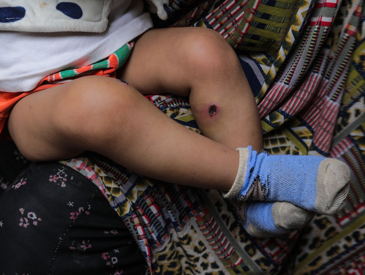 تعرض الرضيع جواد أسامة أبو نصار لإصابات جسدية ونفسية بعد اعتقاله هو ووالده من قبل القوات الإسرائيلية قرب مخيم المغازي للاجئين في قطاع غزة، 24 مارس/آذار 2026. صورة: رمزي أبو عامر