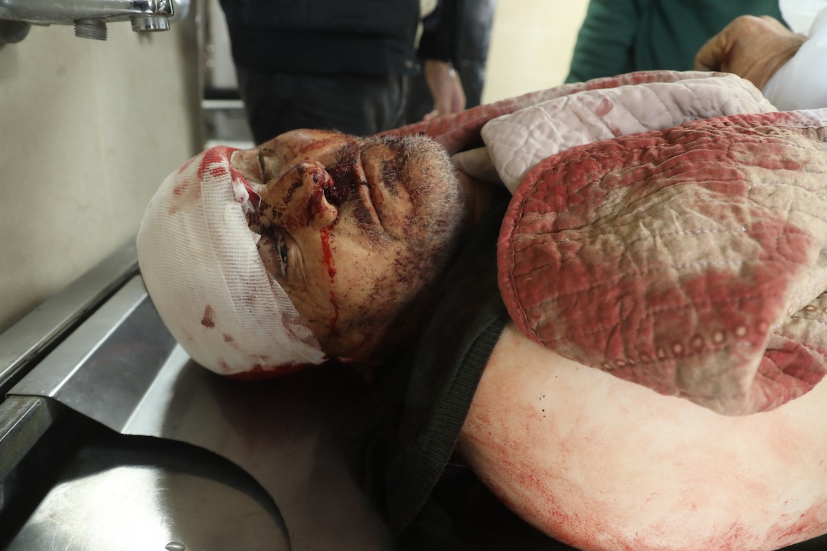 في الثاني من مارس/آذار 2026، نقل مسعفون وسكان محليون جثماني الفلسطينيين محمد وفهيم معمر، بعد استشهادهما على يد مستوطنين إسرائيليين في قرية قريوت، إلى مستشفى الرفيديا بمدينة نابلس في الضفة الغربية. وأعلنت وزارة الصحة الفلسطينية عن إصابة ثلاثة أشخاص آخرين، بينهم طفل. (صورة: محمد ناصر)