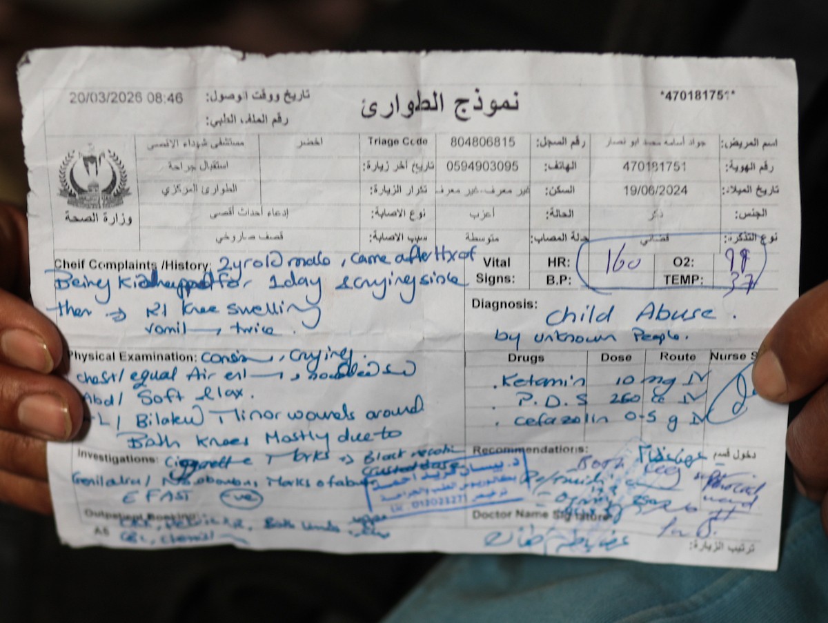 تعرض الرضيع جواد أسامة أبو نصار لإصابات جسدية ونفسية بعد اعتقاله هو ووالده من قبل القوات الإسرائيلية قرب مخيم المغازي للاجئين في قطاع غزة، 24 مارس/آذار 2026. صورة: رمزي أبو عامر