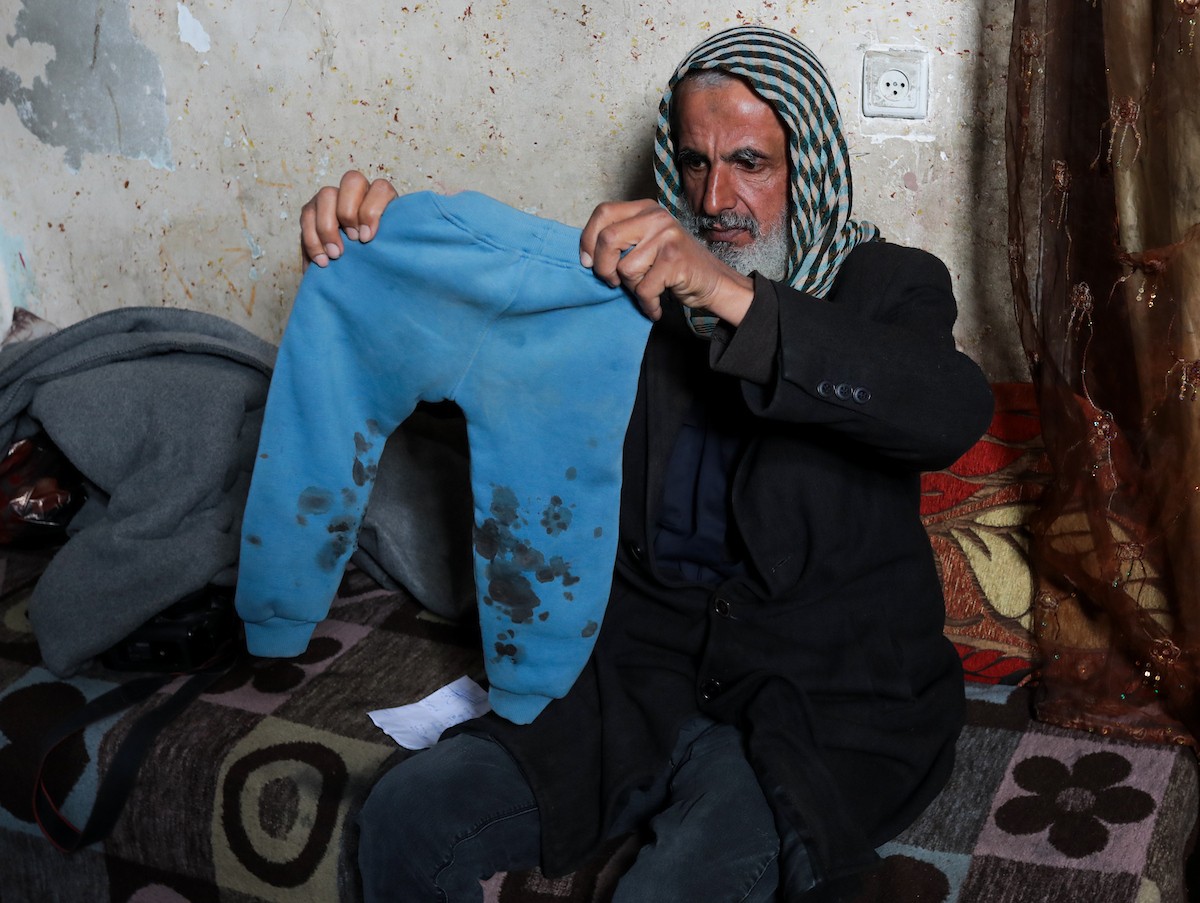 تعرض الرضيع جواد أسامة أبو نصار لإصابات جسدية ونفسية بعد اعتقاله هو ووالده من قبل القوات الإسرائيلية قرب مخيم المغازي للاجئين في قطاع غزة، 24 مارس/آذار 2026. صورة: رمزي أبو عامر