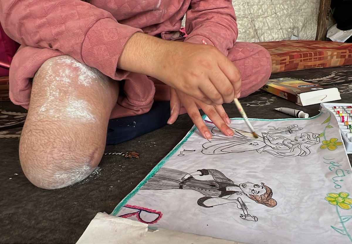 منة وائل عاشور (12 عاماً) وشقيقها فايز (24 عاماً) يعيشان في خيمة نزوح بمدينة دير البلح وسط قطاع غزة، بعد أن فقدا أطرافهما جراء هجوم إسرائيلي قبل نحو تسعة أشهر، 16 أبريل/نيسان 2026. صورة: يوسف أبو طفة