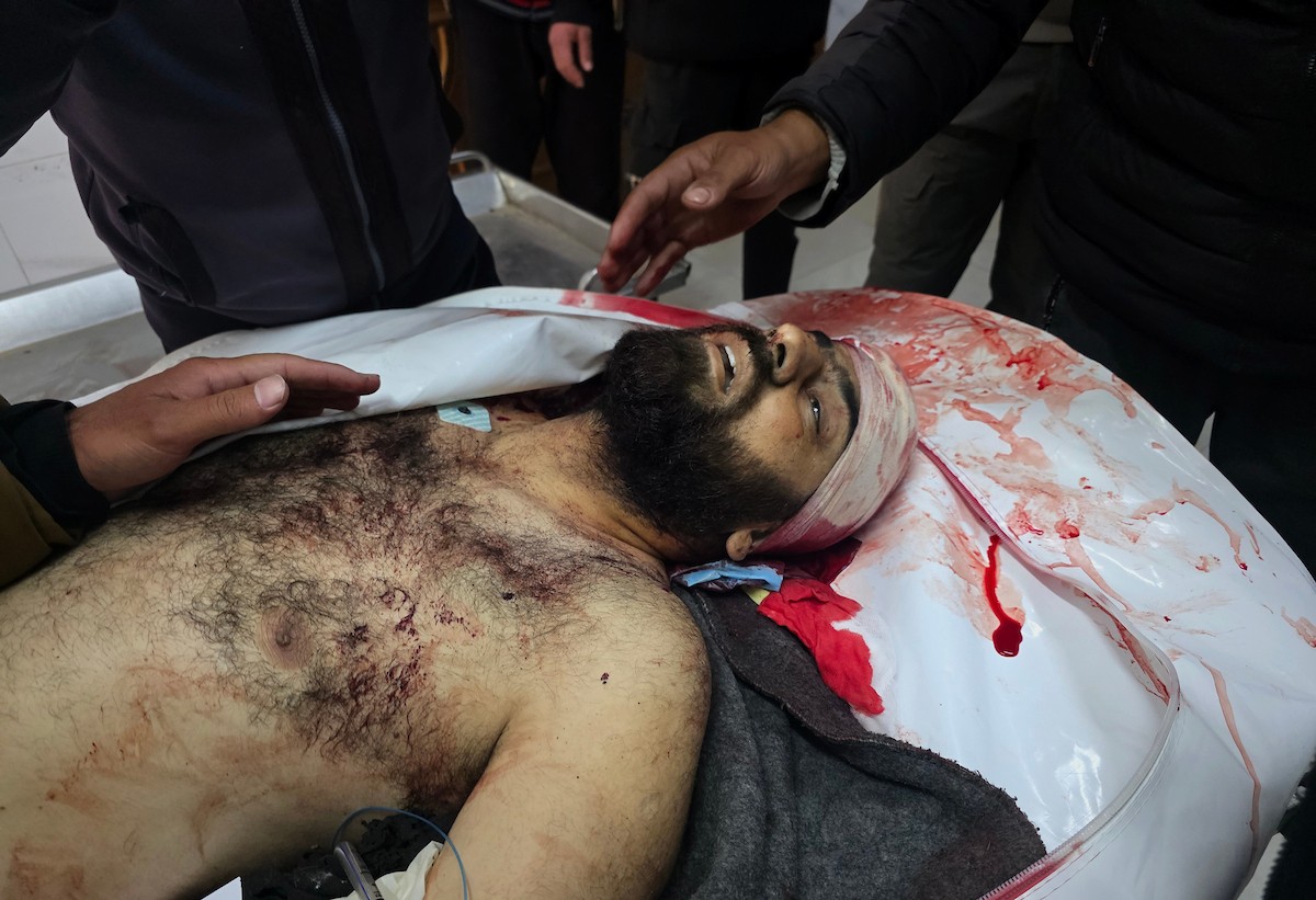 وصل جثمان رجل فلسطيني وعدد من الجرحى إلى مستشفى ناصر عقب غارة جوية إسرائيلية استهدفت مركزًا للشرطة الفلسطينية في خان يونس، جنوب قطاع غزة، في 31 مارس/آذار 2026. (صورة: طارق محمد)