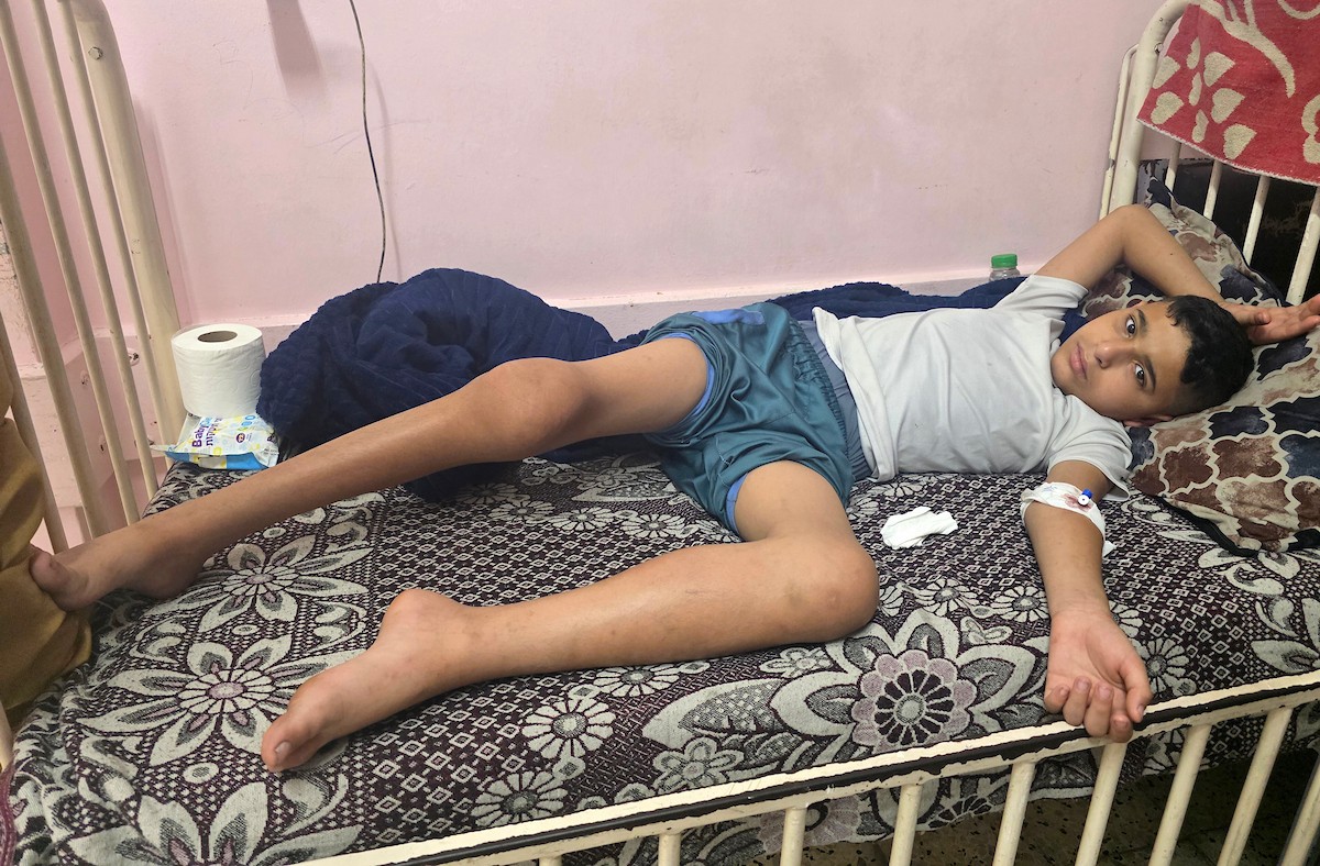 الطفل وليد أبو مصطفى يتلقى الرعاية في مجمع ناصر الطبي بخان يونس، بعد تدهور حالته الصحية جراء إصابته بمرض الهيموفيليا ونزيف متكرر في المفاصل، وسط مناشدات عائلته لتحويله للعلاج خارج القطاع، 22 أيار/مايو 2026. تصوير: طارق محمد.
