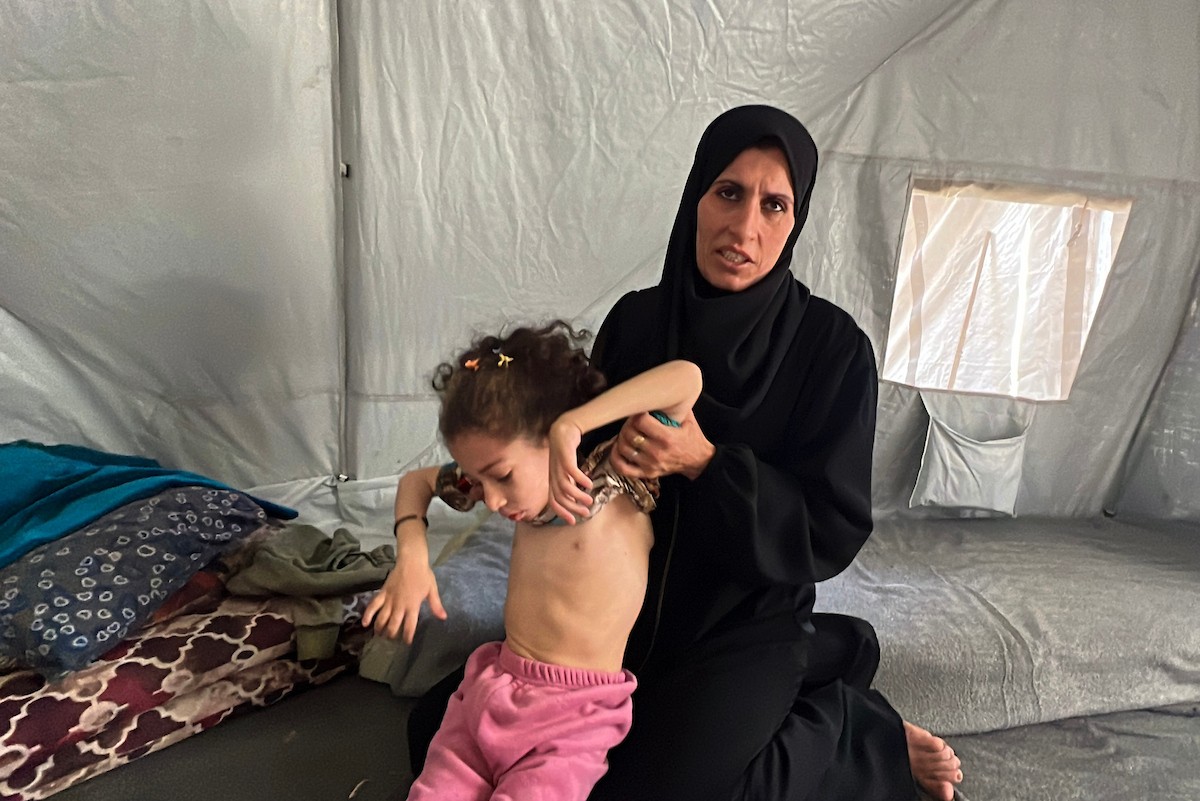 الطفلة داليا الزويدي تتلقى الرعاية من والديها داخل خيمة نزوحهم في مخيم النصيرات، تعاني داليا من نقص الأكسجين وسوء التغذية وسط تدهور الأوضاع الصحية ونقص الغذاء والدواء في القطاع، 10 أيار/ مايو 2026.(صورة: يوسف أبو وطفة)