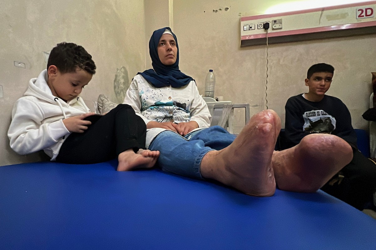 أفراد من عائلة الفلسطيني ياسر عماد ديب يتلقون العلاج في مستشفى شهداء الأقصى بدير البلح وسط قطاع غزة، في 12 مايو/أيار 2026، بعد نحو عام على إصابتهم في هجوم إسرائيلي قرب خيمتهم غرب المدينة، ما تسبب بحروق وبتر أطراف وإعاقات دائمة. تصوير: يوسف أبو وطفة