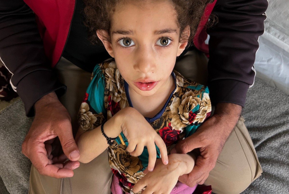 الطفلة داليا الزويدي تتلقى الرعاية من والديها داخل خيمة نزوحهم في مخيم النصيرات، تعاني داليا من نقص الأكسجين وسوء التغذية وسط تدهور الأوضاع الصحية ونقص الغذاء والدواء في القطاع، 10 أيار/ مايو 2026.(صورة: يوسف أبو وطفة)