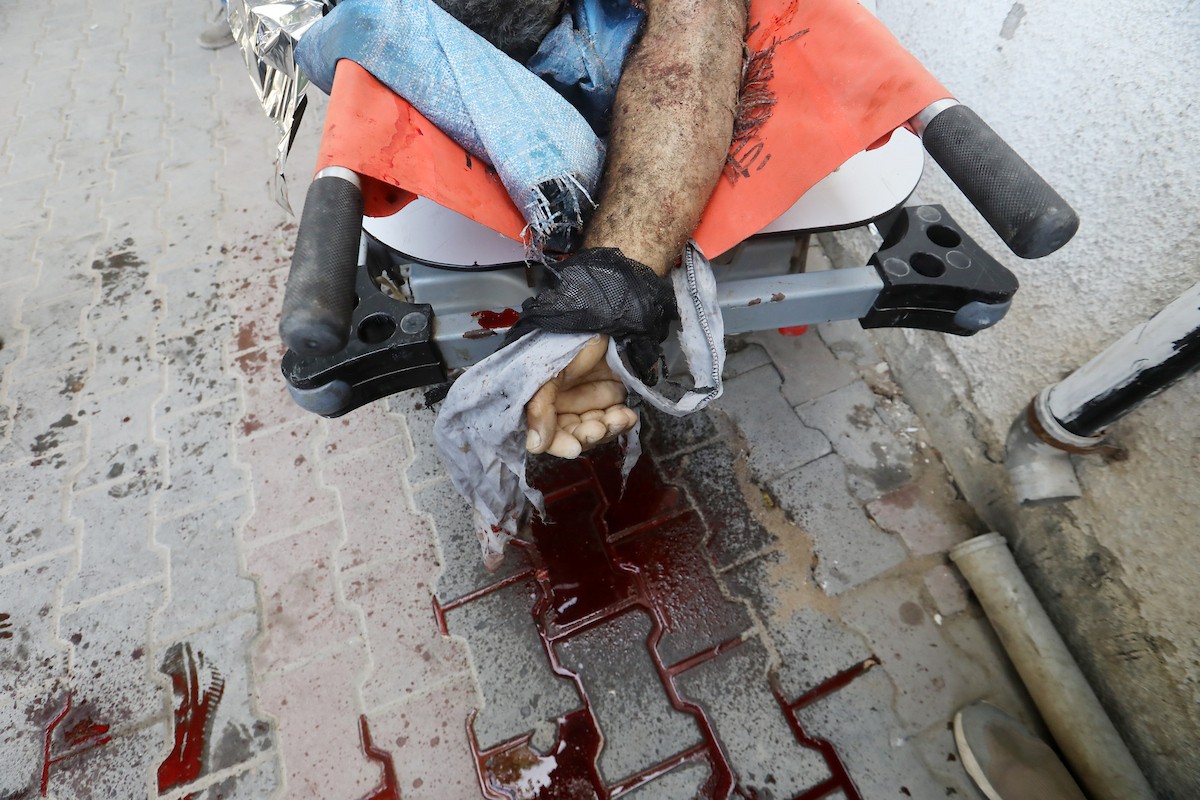 ينوح فلسطينيون على جثمان رجل في مستشفى الشفاء بمدينة غزة، في 9 أيار/ مايو 2026، بعد استشهاده إثر استهداف طائرة مسيرة إسرائيلية دراجة كهربائية كان يستقلها شمال المدينة، بحسب تقارير محلية. تصوير: بلال أسامة